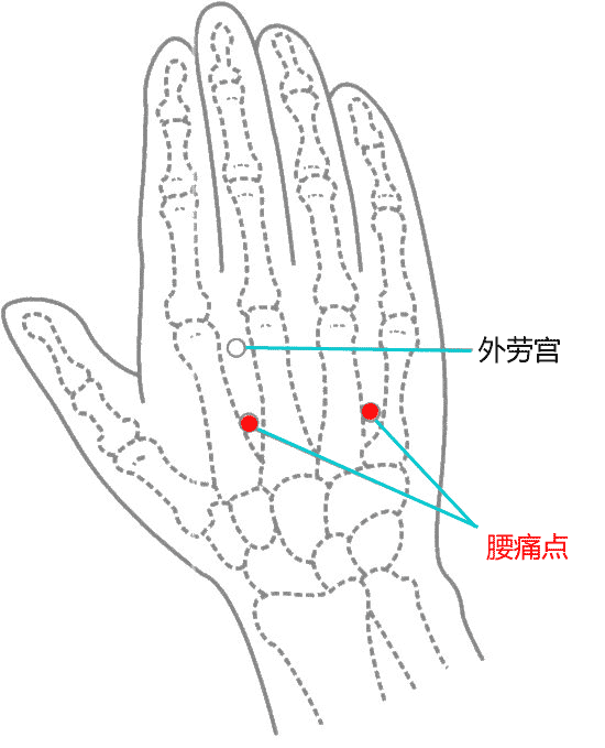 腰痛点穴